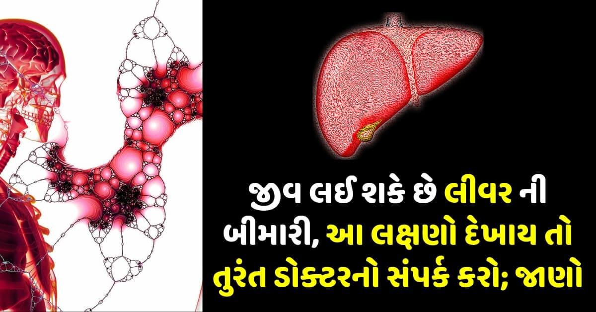 જીવ લઈ શકે છે લીવર ની બીમારી, આ લક્ષણો દેખાય તો તુરંત ડોક્ટરનો સંપર્ક કરો